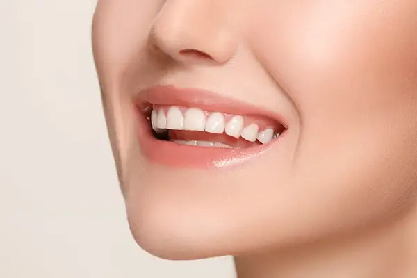 Blanqueamiento dental Cancún