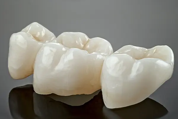 Carillas dentales Cancún