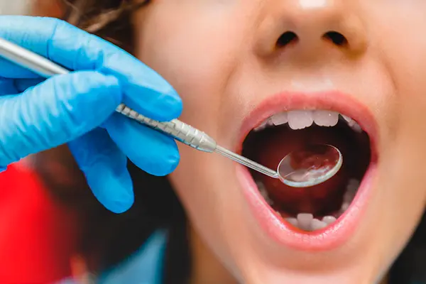 Odontología Pediátrica Cancún