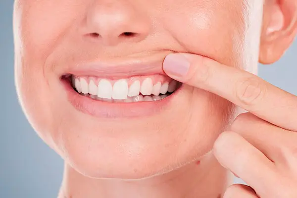Periodoncia Cancún